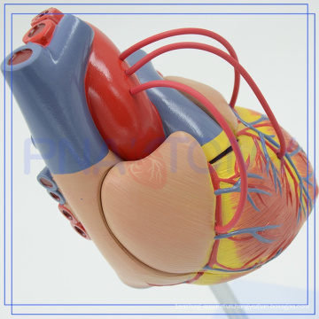 PNT-0400a Hot Sell Atherosclerosis Plastic Human Heart Model